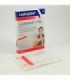 LEUKOMED T PLUS APOSITO ESTERIL ADH 8 X 10 CM 5